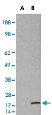 Anti-RPS19 Goat Polyclonal Antibody