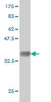 Anti-DLG1 Mouse Monoclonal Antibody [clone: 1D8]