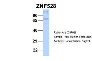 Anti-ZNF528 Rabbit Polyclonal Antibody