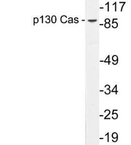 Western blot analysis of lysates from HepG2 cells using Anti-p130 Cas Antibody