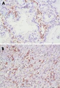 Anti-CD38 Mouse Monoclonal Antibody [clone: 6E12D]