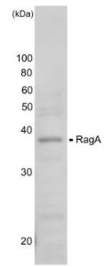 Anti-Rag A Antibody