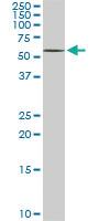 Anti-DPH2 Mouse Monoclonal Antibody [clone: 5B10]