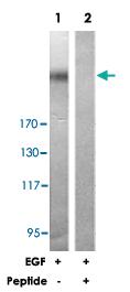 Anti-POLR2A Rabbit Polyclonal Antibody