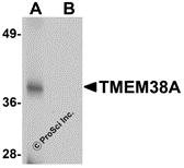 Western blot analysis of TMEM38A in rat skeletal muscle tissue lysate with TMEM38A antibody at 1 &#956;g/mL in (A) the absence and (B) the presence of blocking peptide.