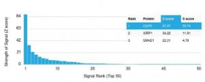 Analysis of protein array containing more than 19,000 full-length human proteins using Anti-EGFR Antibody [GFR/2341]