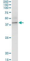 Anti-BCAT2 Mouse Polyclonal Antibody