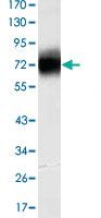 Anti-CD38 Mouse Monoclonal Antibody [clone: 6E12D]