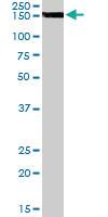 Anti-EPB41L3 Goat Polyclonal Antibody