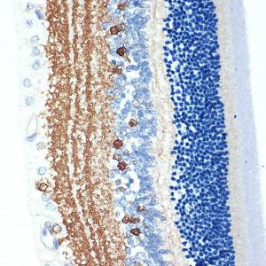 Immunohistochemistry analysis of paraffin-embedded rat retina using Anti-CRABP1 Antibody [ARC1991] (A308999) at a dilution of 1:100 (40x lens) Perform microwave antigen retrieval with 10 mM Tris/EDTA buffer pH 90 before commencing with IHC staining protocol