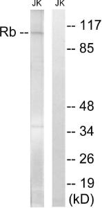 Western blot analysis of lysates from Jurkat cells, treated with PMA 125ng/ml 30' using Anti-Retinoblastoma Antibody. The right hand lane represents a negative control, where the antibody is blocked by the immunising peptide