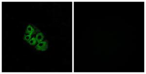 Immunofluorescence analysis of A549 cells using Anti-LSHR Antibody. The right hand panel represents a negative control, where the antibody was pre-incubated with the immunising peptide.