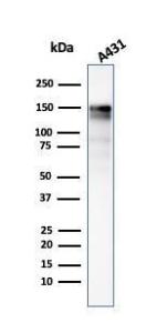 Western blot analysis of A431 cell lysate using Anti-EGFR Antibody [GFR/2341]