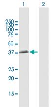 Anti-BCAT2 Rabbit Polyclonal Antibody