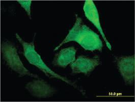 Anti-PUS1 Mouse Monoclonal Antibody [clone: 3A3]