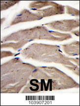 Anti-PFKM Rabbit Polyclonal Antibody (Biotin)