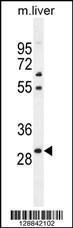 Anti-PHOX2B Rabbit Polyclonal Antibody (FITC (Fluorescein Isothiocyanate))