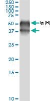 Anti-BCAT2 Rabbit Polyclonal Antibody