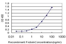 Anti-DPH2 Mouse Monoclonal Antibody [clone: 5B10]