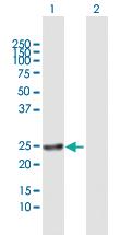 Anti-RAB22A Mouse Polyclonal Antibody