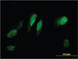 Anti-RGCC Mouse Monoclonal Antibody [clone: 3B9]