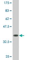 Anti-DLG1 Mouse Monoclonal Antibody [clone: 1D8]