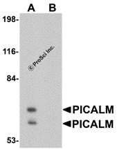 Western blot analysis of PICALM in EL4 cell lysate with PICALM antibody at 1 &#956;g/mL in (A) the absence and (B) the presence of blocking peptide.