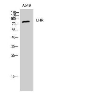 Western blot analysis of A549 cells using Anti-LSHR Antibody