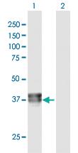 Anti-BCAT2 Rabbit Polyclonal Antibody