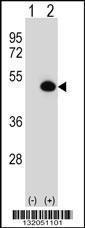 Anti-ASS1 Rabbit Polyclonal Antibody (HRP (Horseradish Peroxidase))