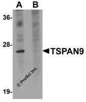 Western blot analysis of TSPAN9 in EL4 cell lysate with TSPAN9 antibody at 1 &#956;g/mL in (A) the absence and (B) the presence of blocking peptide.