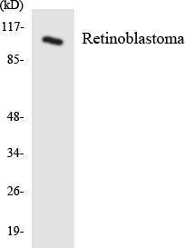 Western blot analysis of the lysates from COLO205 cells using Anti-Retinoblastoma Antibody