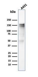 Western blot analysis of A431 cell lysate using Anti-EGFR Antibody [SPM341]