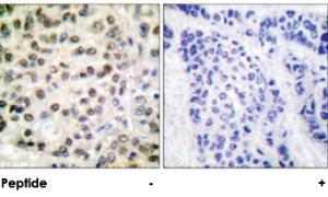 Anti-POLR2A Rabbit Polyclonal Antibody