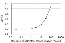 Anti-CCNE1 Polyclonal Antibody Pair