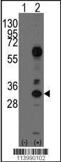 Anti-CD8A Rabbit Polyclonal Antibody (APC (Allophycocyanin))