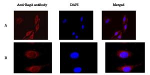 Anti-Rag A Antibody