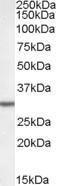 Anti-Dpm1 Antibody (A84599) (0.05 µg/ml) staining of Rat Liver lysate (35 µg protein in RIPA buffer). Primary incubation was 1 hour. Detected by chemiluminescence