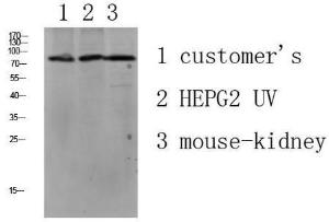 Western blot analysis of various lysate using Anti-LSHR Antibody