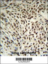 Anti-SNRPD3 Rabbit Polyclonal Antibody