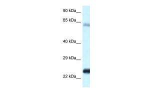 Anti-NDUFS8 Rabbit Polyclonal Antibody