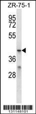 Anti-MFSD2B Rabbit Polyclonal Antibody (HRP (Horseradish Peroxidase))