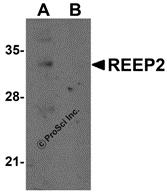 Western blot analysis of REEP2 in mouse lung tissue lysate with REEP2 antibody at 1 &#956;g/mL in (A) the absence and (B) the presence of blocking peptide.