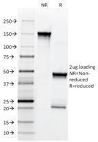 SDS-PAGE analysis of Anti-p75 NGF Receptor Antibody [NGFR5] under non-reduced and reduced conditions; showing intact IgG and intact heavy and light chains, respectively. SDS-PAGE analysis confirms the integrity and purity of the antibody.