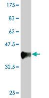 Anti-DLG1 Mouse Monoclonal Antibody [clone: 1B12]