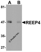 Western blot analysis of REEP4 in human lung tissue lysate with REEP4 antibody at 1 µg/mL in (A) the absence and (B) the presence of blocking peptide.