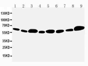 Anti-Apoptosis inhibitor 5 Rabbit Polyclonal Antibody