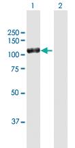 Anti-DPP4 Mouse Polyclonal Antibody