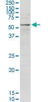 Anti-MECP2 Rabbit Polyclonal Antibody