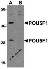 Western blot analysis of POU5F1 in mouse liver tissue lysate with POU5F1 antibody at 1 µg/mL in (A) the absence and (B) the presence of blocking peptide.